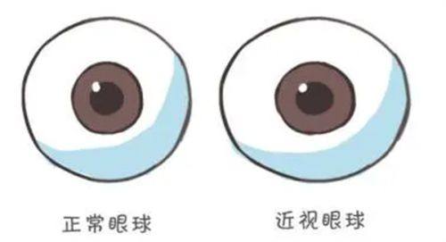 二、北京何氏眼科医院收费标准背后的优势