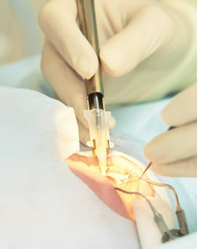 八、长治爱尔眼科医院价格贵不贵？