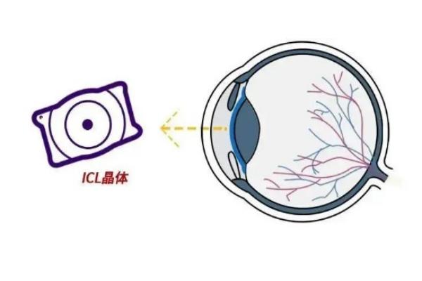 山东菏泽福仁眼科技术好吗？揭秘其多领域技术优势成当地眼科优选