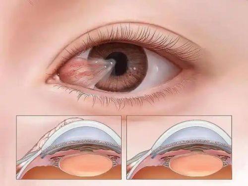 保定新视眼科医院营业时间公布！周一至周日 8:00 - 17:30，这时间看病超方便，真的不了解下？ 