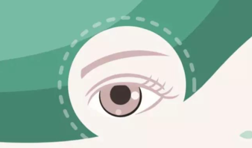 山东爱维视眼科医院术后体验与价格的性价比