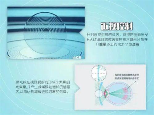 延吉爱尔眼科医院预约挂号怎么操作？线上线下多种方式超便捷，快来试试吧！ 