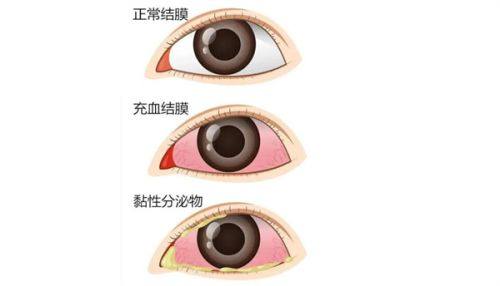 六、昆明景远眼科医院价格情况