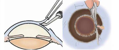 二、 找乐山犍为爱尔眼科医院，除了地址还得知道这些“隐藏优势”！