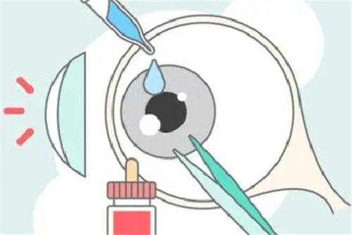 总结:商丘市第一人民医院眼科怎么挂号预约?www.web508.com