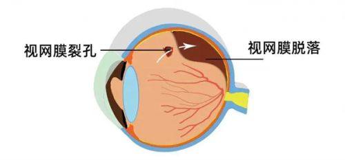 二、在湖州,如何选择一家靠谱的近视手术医院www.web508.com