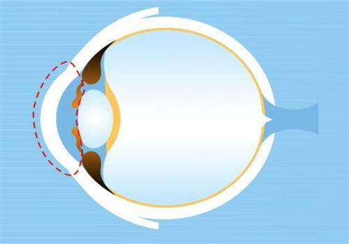 三、长治眼科医院挂号网上预约查询：这3个细节别忘，避免白跑www.web508.com
