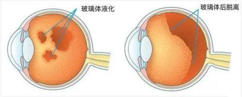 二、梅州眼科医院挂号网上预约查询:两家医院特色服务,选对不踩坑!www.web508.com