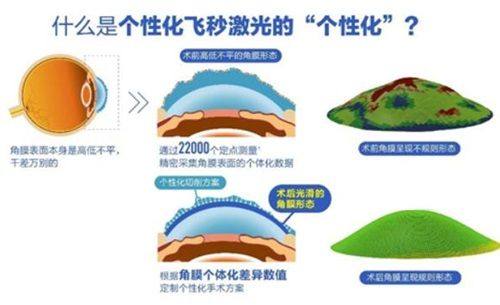 二、实地探访维视眼科：藏在CBD里的“多巴胺”视觉健康中 心www.web508.com