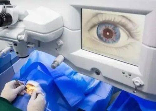 德视佳眼科价格如何？全飞秒2 - 2.6万、ICL3.3 - 3.8万等，多术式优价助您清晰看世界！ 