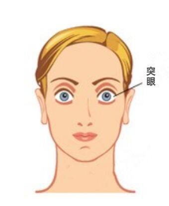 新疆医科大学第一附属医院眼科是公立的吗？是的，其资质全设备优 