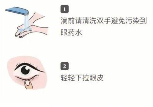 二、在北京怀柔做白内障手术，为什么大家都说修复快？www.web508.com