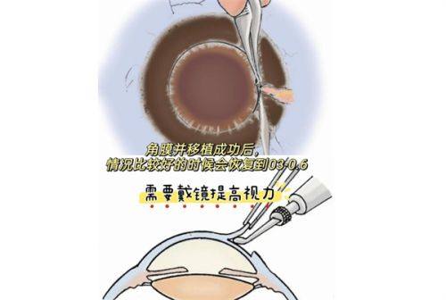 二、合肥华厦眼科价格表背后的成效及优势www.web508.com