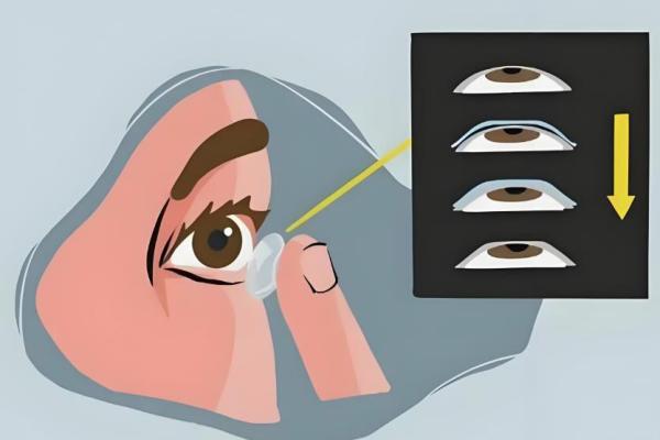 镇江华厦眼科在哪个区？就在镇江京口区建新东路，近视手术价格透明！