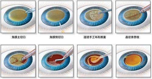 四、上海未来视界眼科医院的口碑评价及实例分享www.web508.com