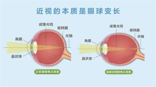 三、深圳深西爱尔眼科医院怎么预约？全新价格明细看这里！www.web508.com