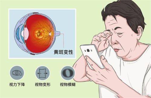 三、深圳深北爱尔眼科医院换义眼怎么预约？价格还有哪些选择？www.web508.com