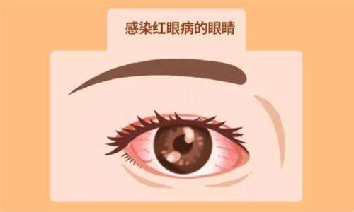 三、深圳深西爱尔眼科医院怎么预约挂号?www.web508.com