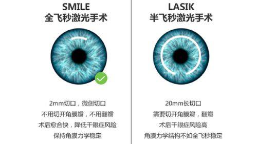近视手术套餐