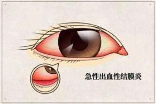 二、角膜移植手术,选对医院和骨干医生有多重要?www.web508.com