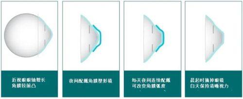 兰州普瑞眼科医院专精的诊疗团队与科室www.web508.com