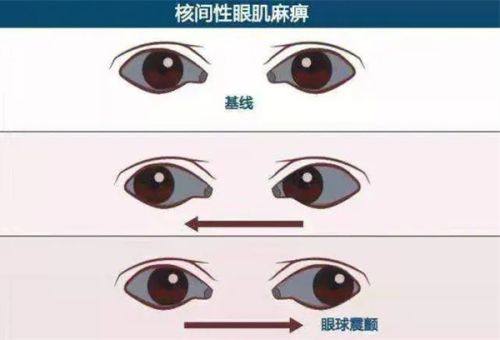 二、北京茗视光眼科医院青光眼诊疗的核心亮点www.web508.com