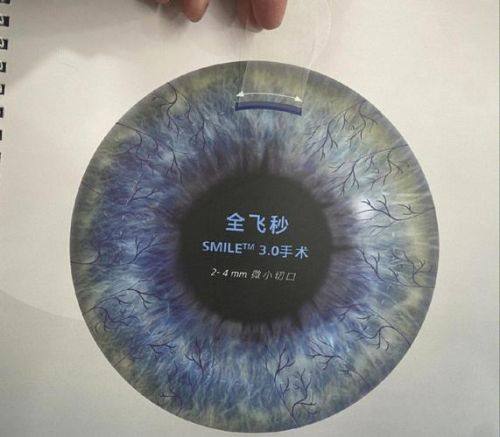 全飞秒价格