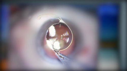 新疆空军眼科医院价格表揭秘：半飞秒12000/全飞秒18000元起