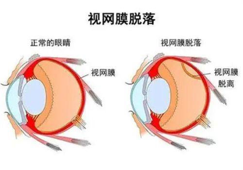 二、新疆空军眼科医院收费贵吗怎么样?www.web508.com