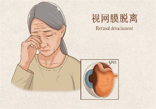 聊城光明眼科医院靠谱吗？当然靠谱！专业团队技术强，助您重见清晰视界！ 