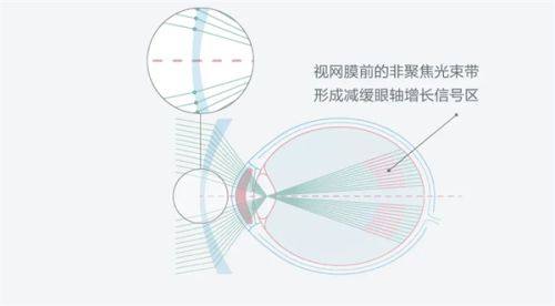 西安奕鸣眼科医院可靠吗？可靠！技术专业服务优，这眼科医院值得选！ 