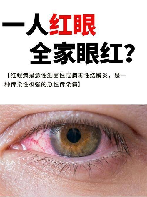 二、梅州爱尔眼科医院的眼科医生靠谱吗?www.web508.com