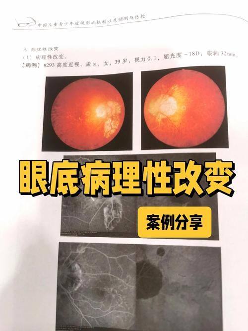三、梅州爱尔眼科医院怎么预约挂号?www.web508.com