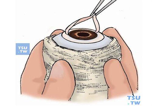 三、邯郸爱尔眼科医院有啥特色治疗项目？www.web508.com