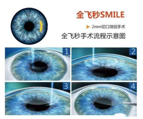 二、台州爱尔眼科实力解析www.web508.com