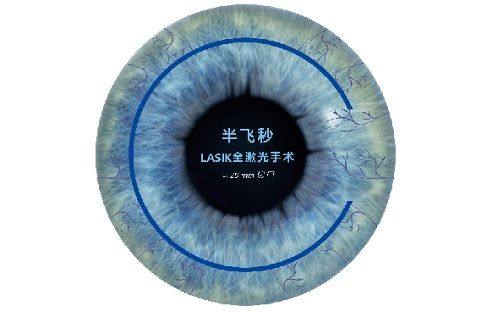 三、北京至亮眼科医院价格贵吗www.web508.com