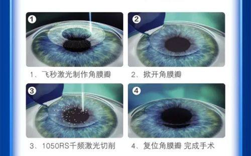 二、东莞虎门做全飞秒哪里好www.web508.com