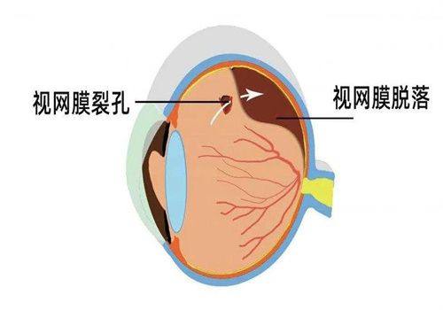 驻马店尖峰眼科医院医生介绍专家团队精湛，全飞秒万元起享透明收费，术后视觉质量更优。