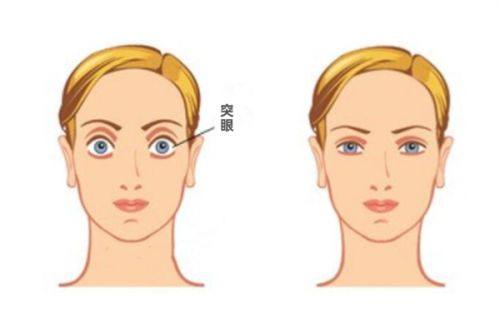 三、重庆华厦眼科医院价格贵不贵www.web508.com