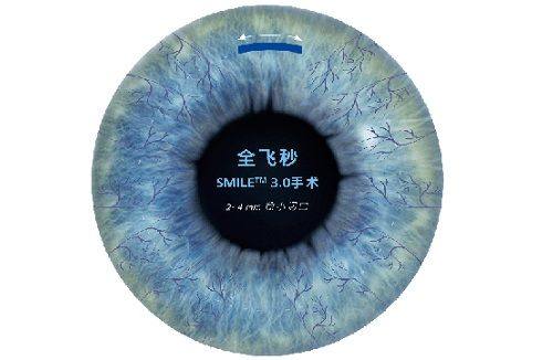 三、烟台眼科就诊价格与预约指南www.web508.com