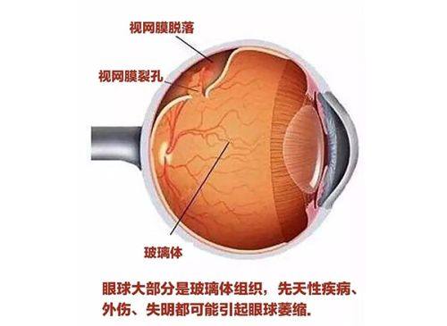 二、北京维视眼科医院的医生团队靠谱吗?www.web508.com