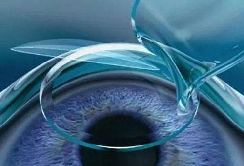 三、昭通艾维眼科挂号方便吗www.web508.com