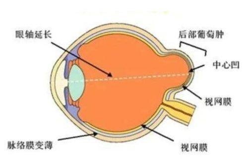 牡丹江爱尔眼科医院技术好吗？专家亲诊设备先进，术后视力稳定恢复快口碑佳