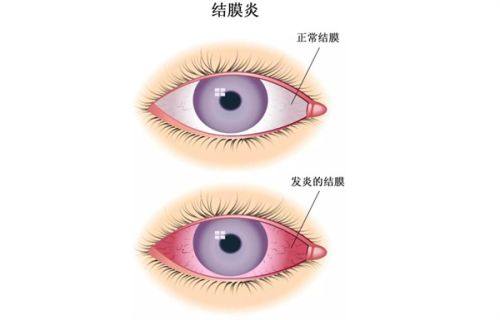 二、牡丹江爱尔眼科做全飞秒手术的医生是谁?技术稳不稳?www.web508.com