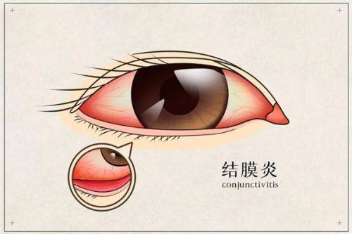 三、在常州华厦谱瑞眼科做手术多少钱及怎么预约?www.web508.com