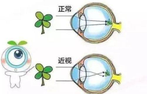 三、想去看眼病,深圳博爱曙光医院怎么预约挂号?www.web508.com