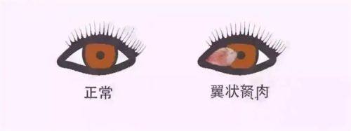 三、武汉华厦眼科收费价格透明吗www.web508.com