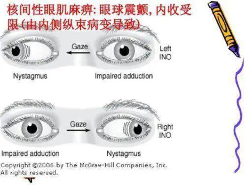 石家庄爱眼眼科医院做近视手术多少钱？全飞秒 9800 元起，摘镜价格透明更安心！