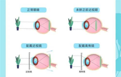 三、去宜春爱尔眼科医院怎么预约挂号？www.web508.com