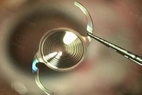 新无极人工晶体怎么样web508.com